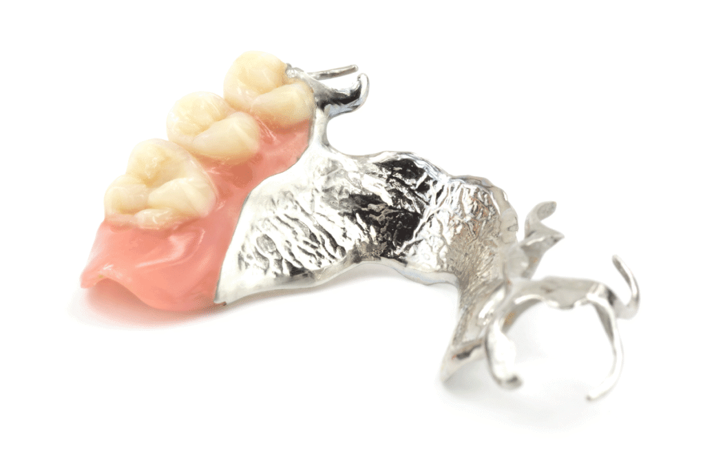 vitallium-removable-partial-denture